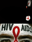 Aids